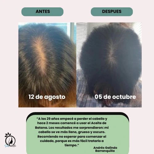 Aceite de Batana 100% Puro Nutre y Fortalece el Cabello