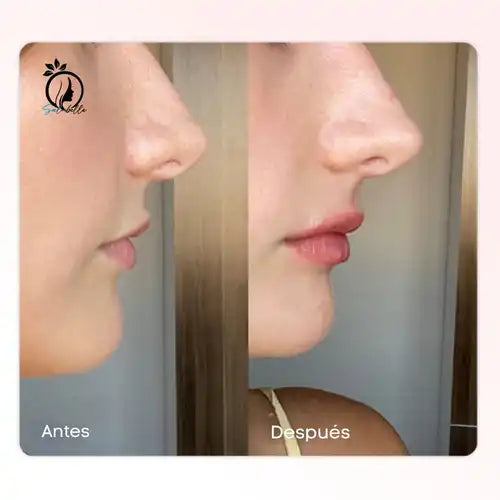 Herbeauty – Labios llenitos al instante, sin aguja ni pegajosidad