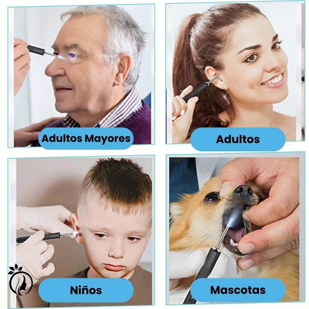 Limpieza Profunda y Segura para tus Oídos