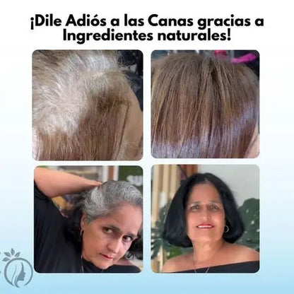 Malaya® Shampoo 3 en 1 + Kit Capilar de Regalo 💜