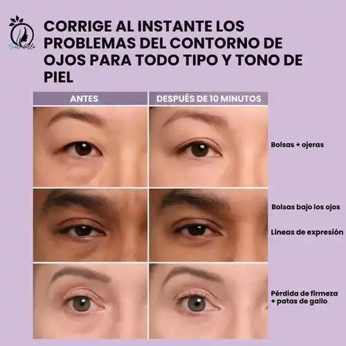 HelveLisse® Tensor temporal Instantáneo Para el Rostro.