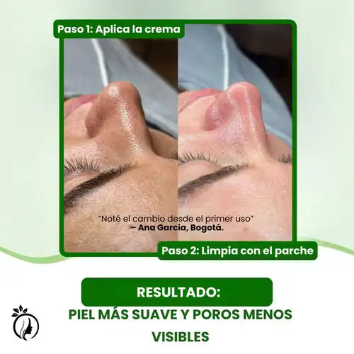 Lanbena 2.0 ® Set Limpiador de Poros con Aloe Vera