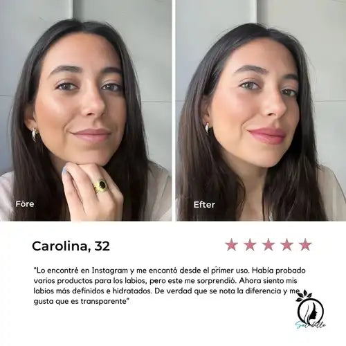 Herbeauty – Labios llenitos al instante, sin aguja ni pegajosidad