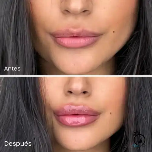 Herbeauty – Labios llenitos al instante, sin aguja ni pegajosidad