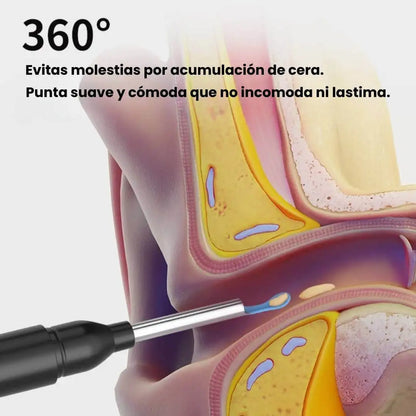 Limpieza Profunda y Segura para tus Oídos