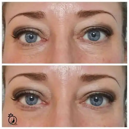 HelveLisse® Tensor temporal Instantáneo Para el Rostro.